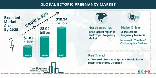 Ectopic Pregnancy Market Growth Analysis Till 2033 By The Business Research Company