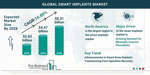 Key Trends And Drivers In The Smart Implants Market 2024