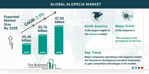 Global Alopecia Market