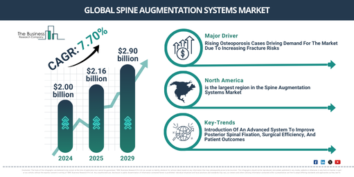 Spine Augmentation Systems Market Trends Report 2025 – For Business Development and Strategy Teams