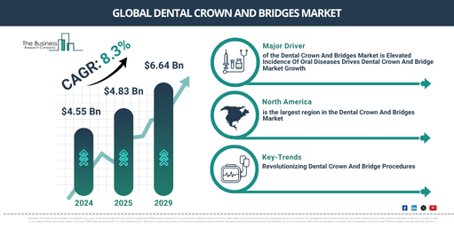 Global Dental Crown And Bridges Market