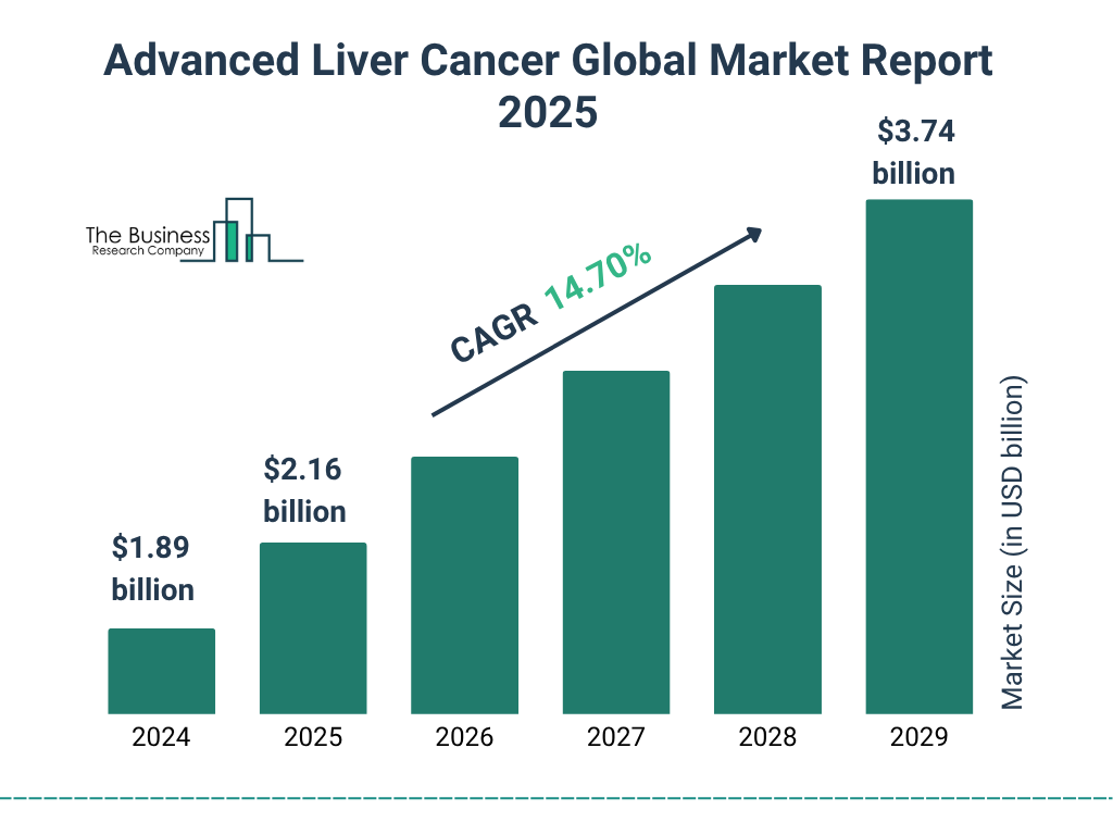 Global Advanced Liver Cancer Market Trends 2025–2029: Regional Outlook and Sizing Analysis