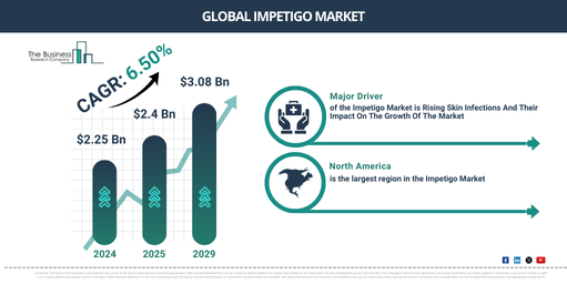 What Is The Forecast Valuation Of The Global Impetigo Market Projected To Reach $3.08 Billion By 2029?