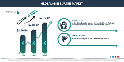 Global Knee Bursitis Market Trends and Future Outlook to 2029