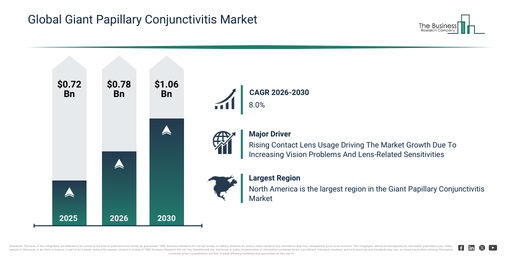 Giant Papillary Conjunctivitis Global Forecast: Market to Scale Up to $1.06 Billion by 2030 at 8% CAGR